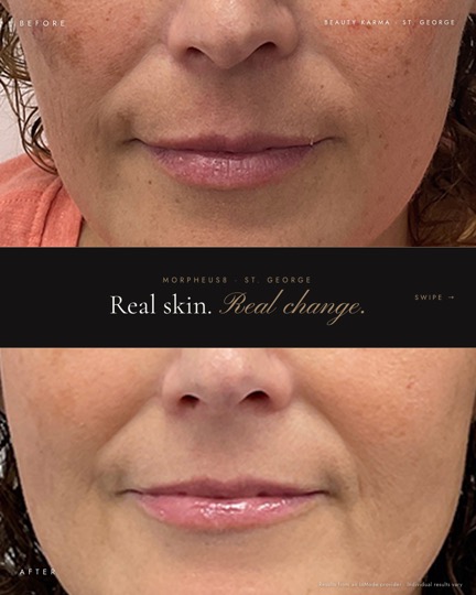 Beauty Karma Instagram post 1